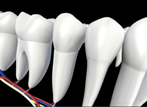 3D dental illustration showing cross-section of teeth with root canal treatment visualization